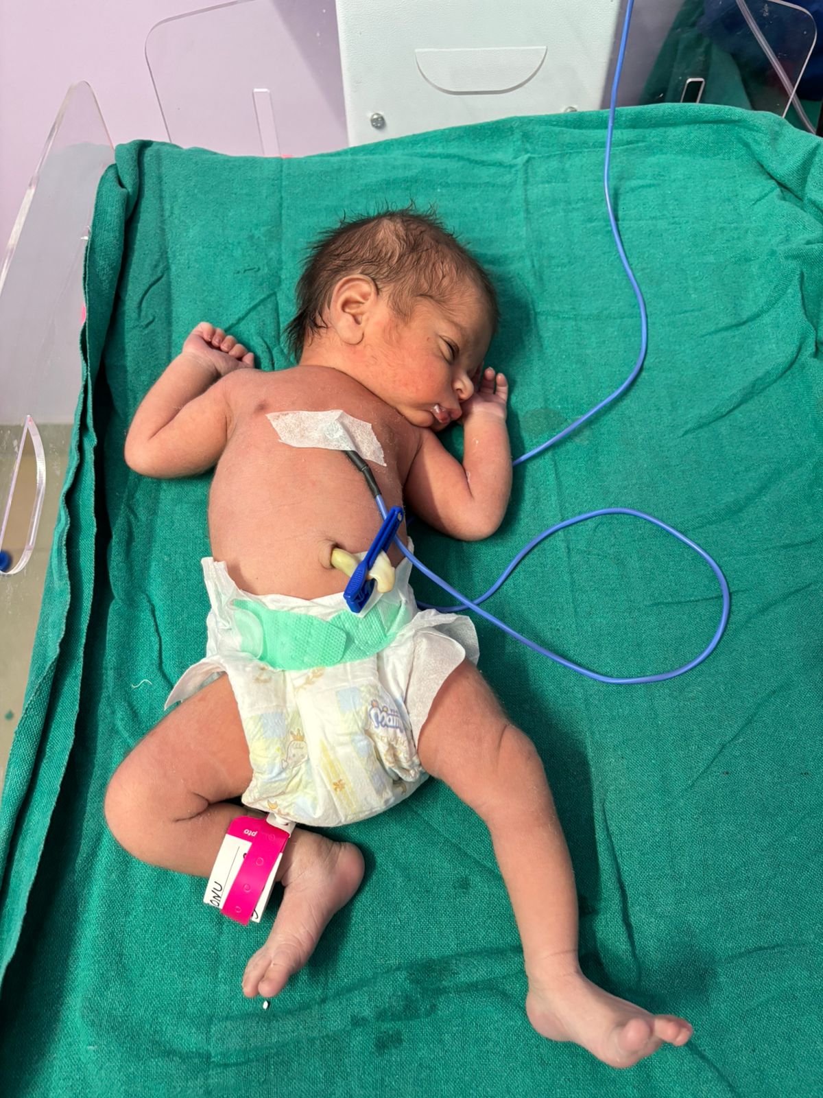 Newborn baby under medical observation